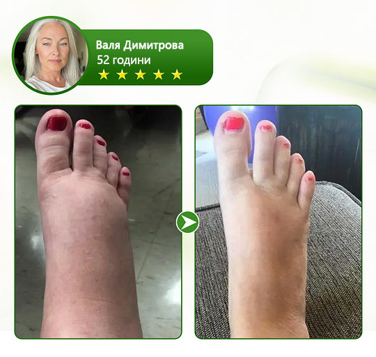 🌿🌿Laleia® професионален крем за грижа за краката