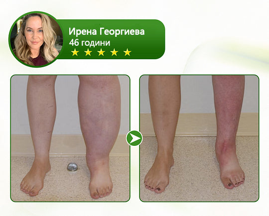 🌿🌿Laleia® професионален крем за грижа за краката