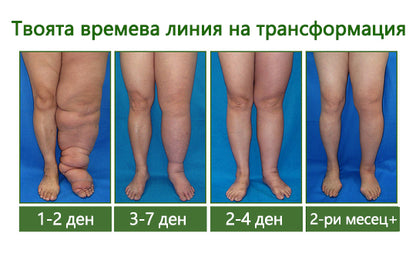 🌿🌿Laleia® професионален крем за грижа за краката