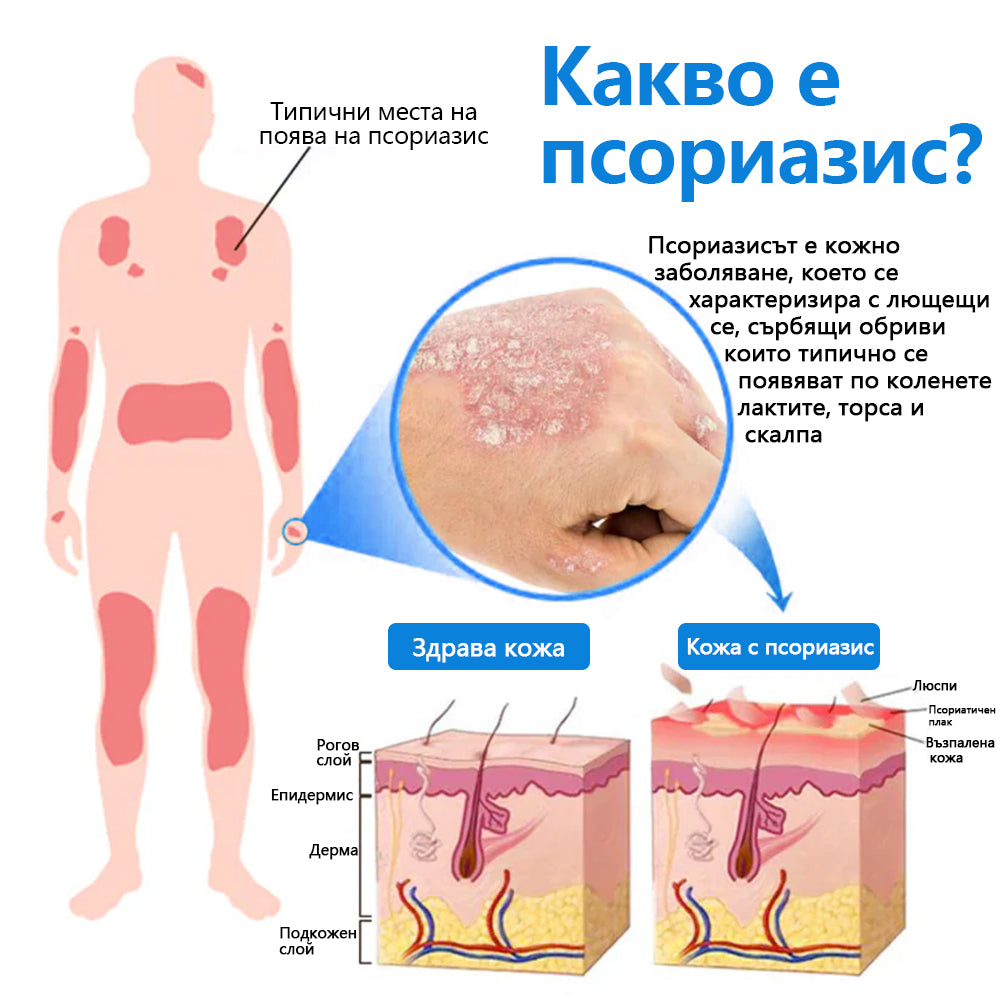 Laleia® Натурален билков спрей с магнезий за псориазис✨✨