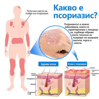 Laleia® Натурален билков спрей с магнезий за псориазис✨✨