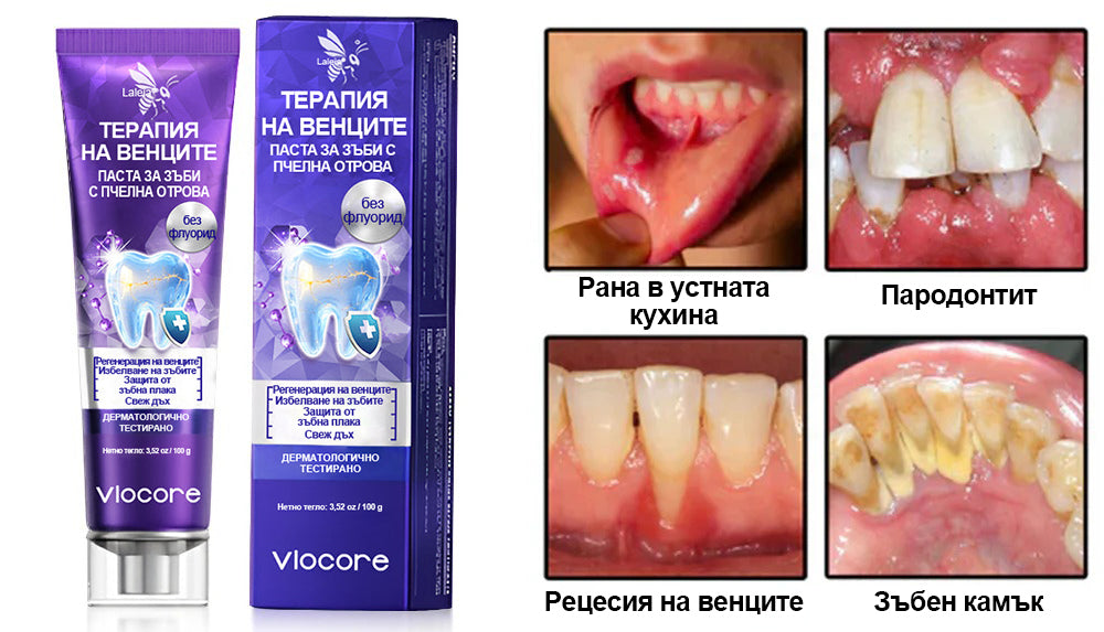 Laleia® VioCore паста за зъби с пчелна отрова за лечение на зъби 🌟🌟