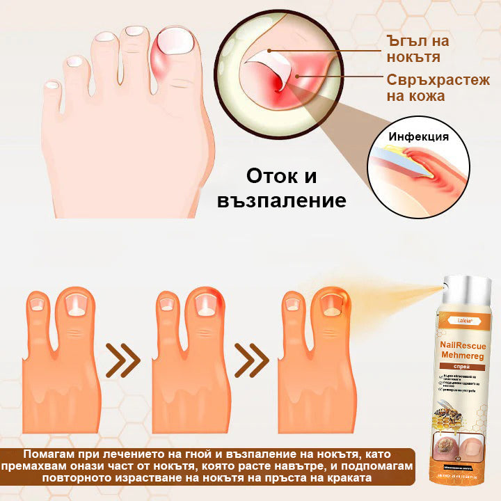 ⭐⭐Laleia® NailRescue спрей с пчелна отрова