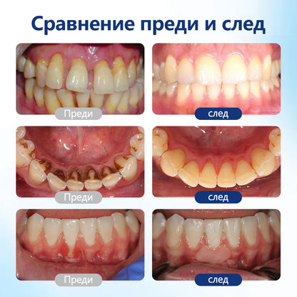 ⭐Laleia® GumViva устен регенериращ разтвор