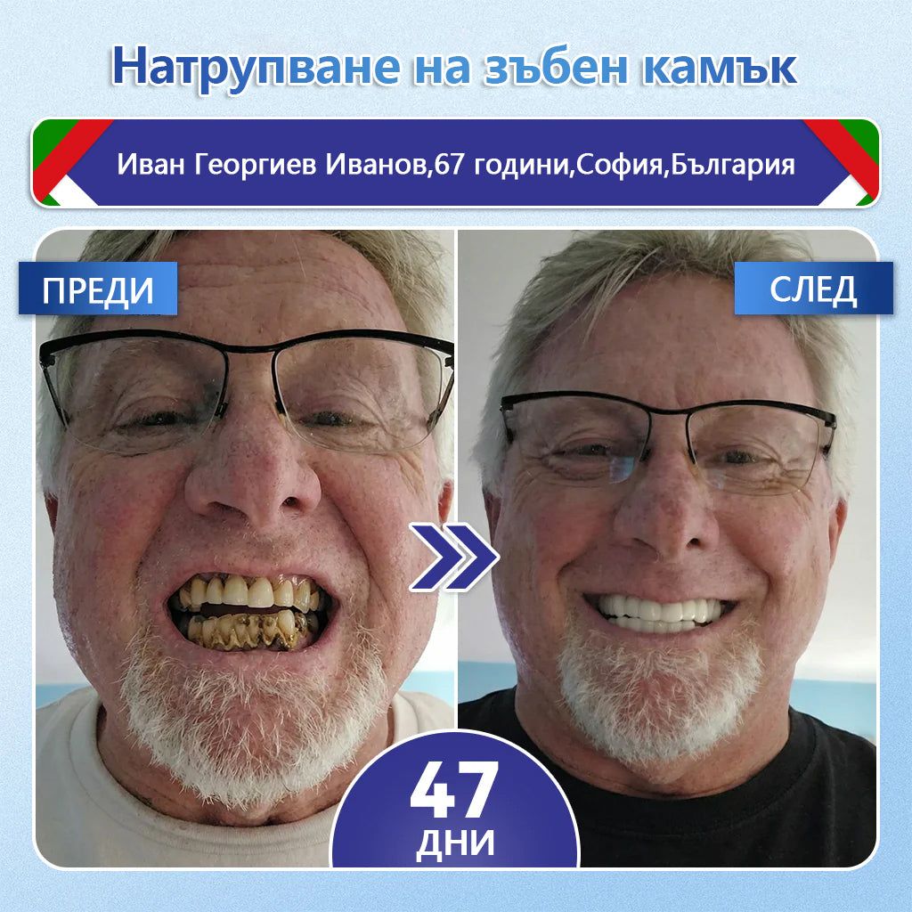 💚Laleia® Tideglusib пластири за възстановяване на зъбите