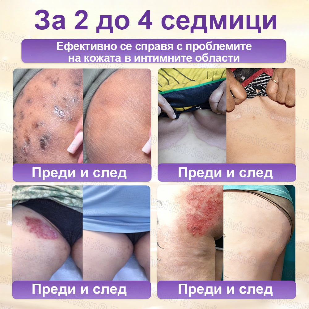 Laleia® Biotin 10 в 1 кожа възстановяващ крем✨