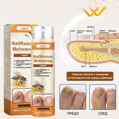 ⭐⭐Laleia® NailRescue спрей с пчелна отрова