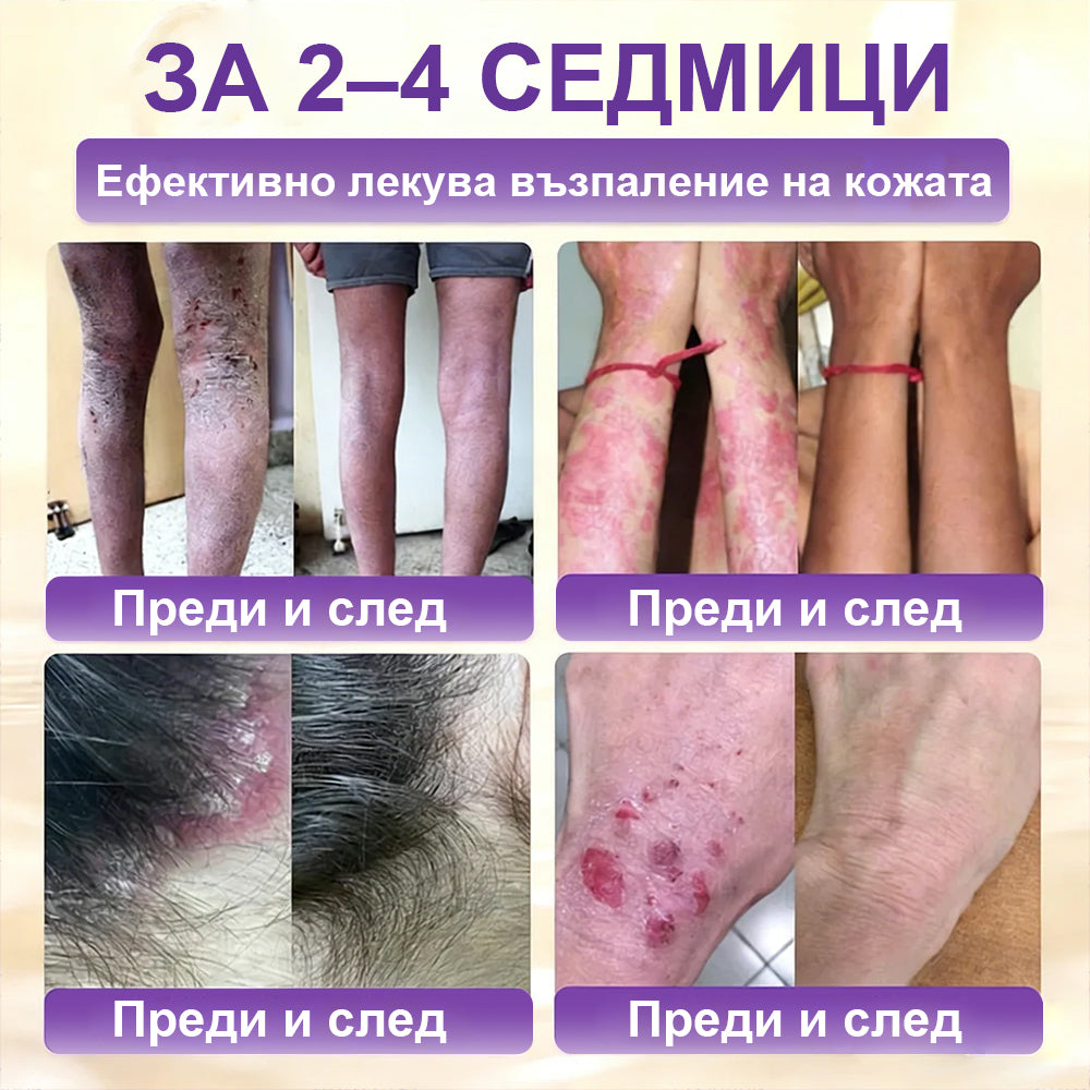 Laleia® Biotin 10 в 1 кожа възстановяващ крем✨