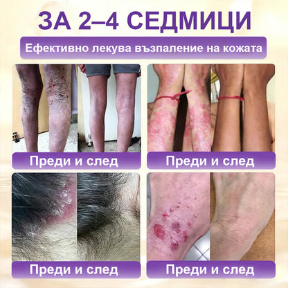 Laleia® Biotin 10 в 1 кожа възстановяващ крем✨