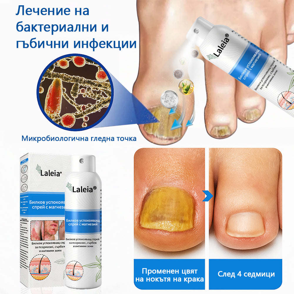 Laleia® Натурален билков спрей с магнезий за псориазис✨✨