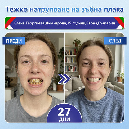 💚Laleia® Tideglusib пластири за възстановяване на зъбите
