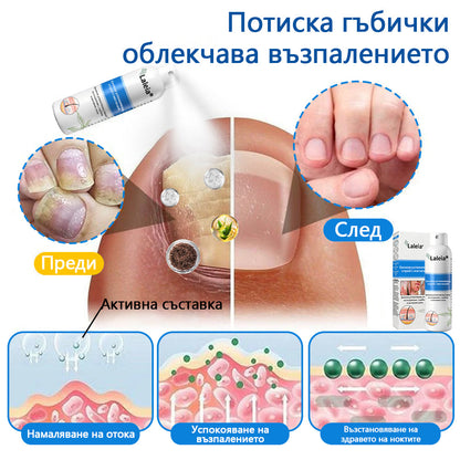 Laleia® Натурален билков спрей с магнезий за псориазис✨✨