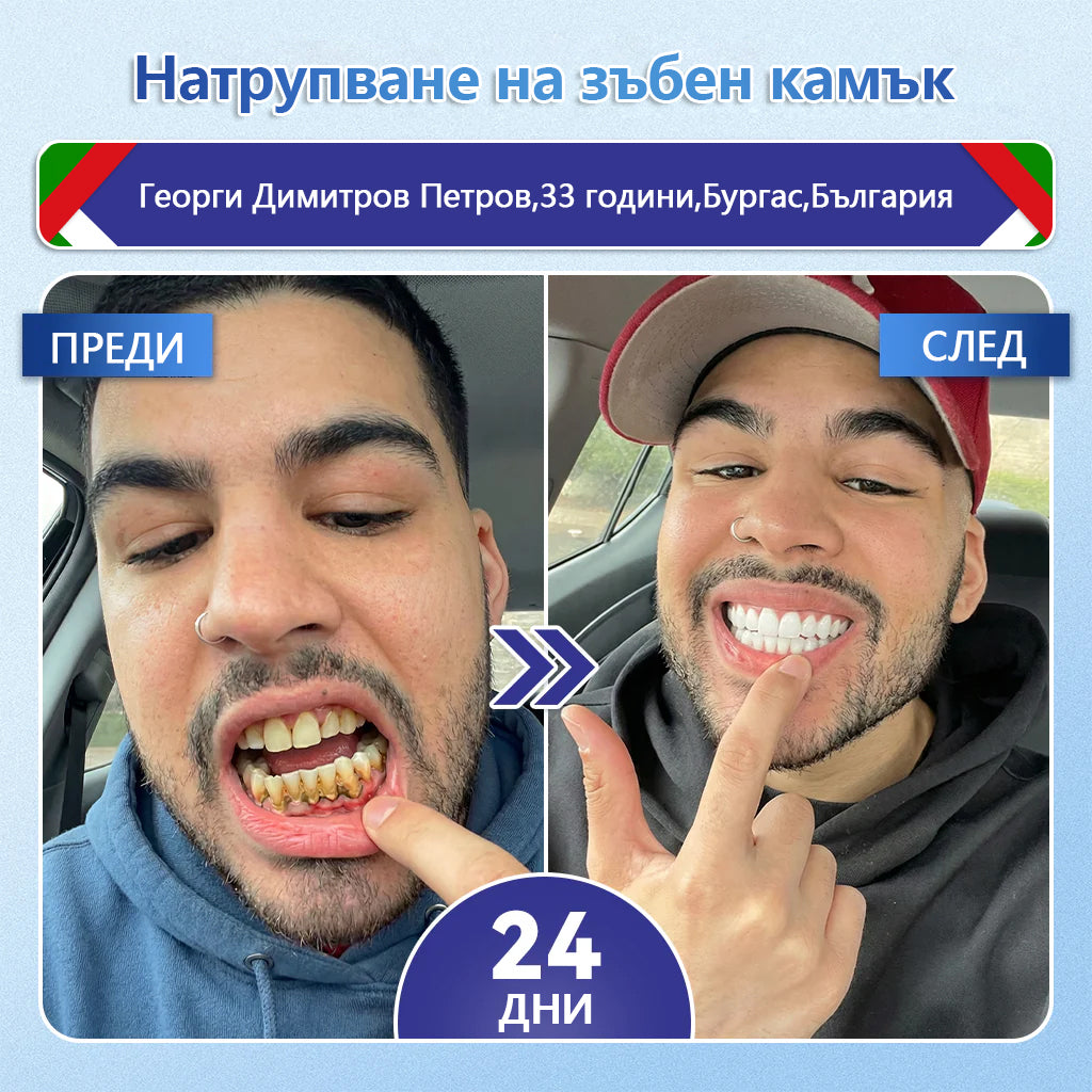 💚Laleia® Tideglusib пластири за възстановяване на зъбите
