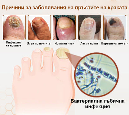 ⭐⭐Laleia® NailRescue спрей с пчелна отрова