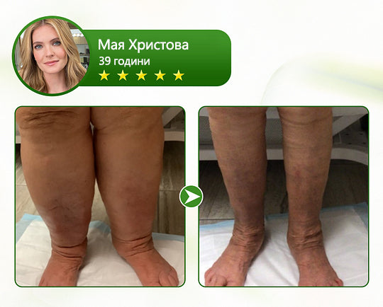 🌿🌿Laleia® професионален крем за грижа за краката